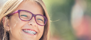 Cost of Braces Near Me in Mountain View CA