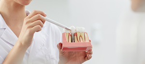 4 Questions to Ask About Dental Implants