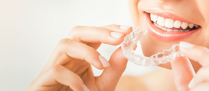 Invisalign Price Near Me in Mountain View, CA Invisalign Price Near Me in Mountain View, CA