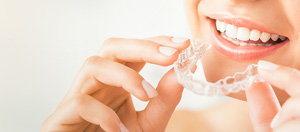Invisalign Price Near Me in Mountain View, CA Invisalign Price Near Me in Mountain View, CA