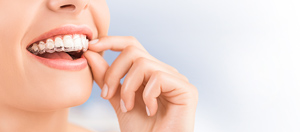 Are You Afraid of the Dentist? Custom Made Mouthguards for National Facial Protection Month