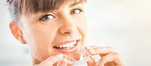 Invisalign vs. Braces for Straightening Your Teeth Questions and Answers Invisalign vs. Braces for Straightening Your Teeth Questions and Answers