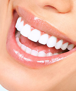 Smile Gallery - Allure Dental Center