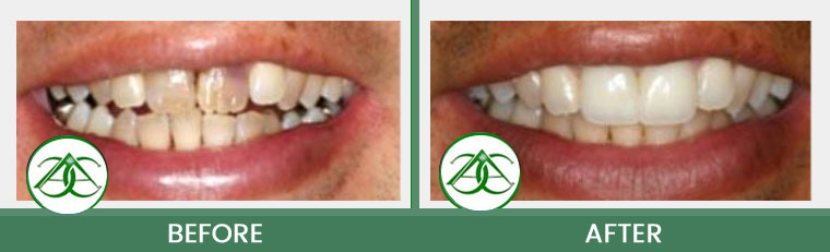 Smile Gallery of Allure Dental Center in Mountain View, CA