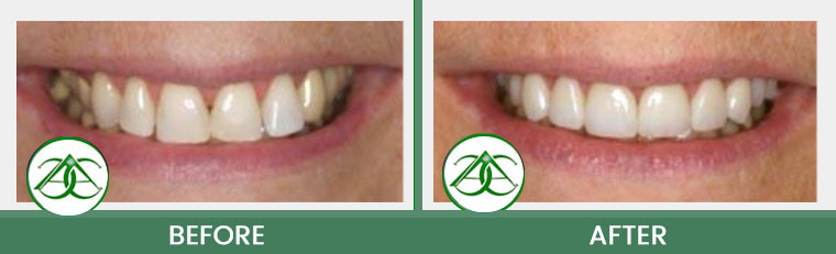 Smile Gallery of Allure Dental Center in Mountain View, CA