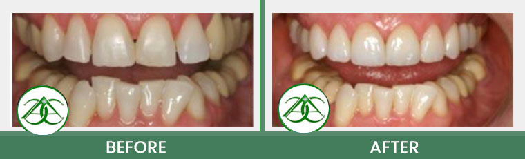 Smile Gallery of Allure Dental Center in Mountain View, CA