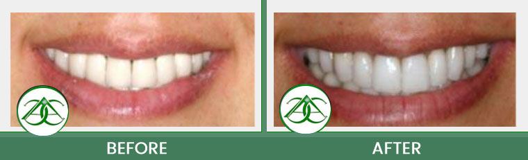 Smile Gallery of Allure Dental Center in Mountain View, CA