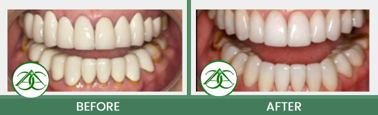 Smile Gallery of Allure Dental Center in Mountain View, CA