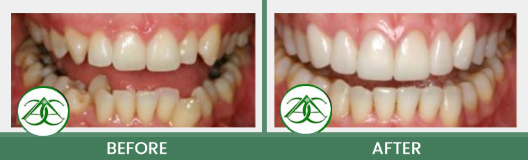 Smile Gallery of Allure Dental Center in Mountain View, CA