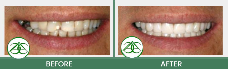 Smile Gallery of Allure Dental Center in Mountain View, CA