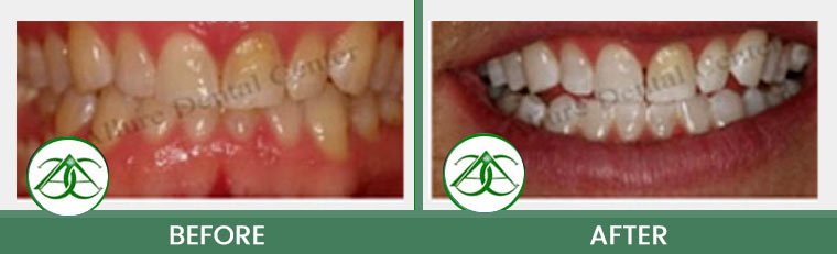 Smile Gallery of Allure Dental Center in Mountain View, CA