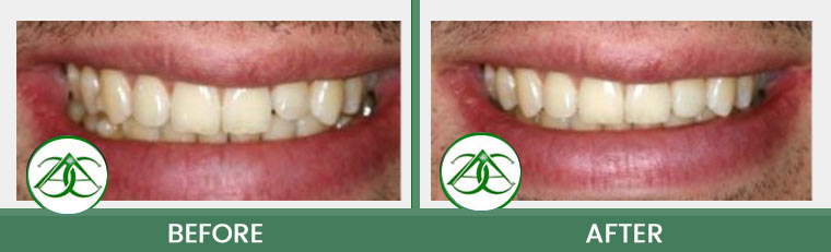 Smile Gallery of Allure Dental Center in Mountain View, CA