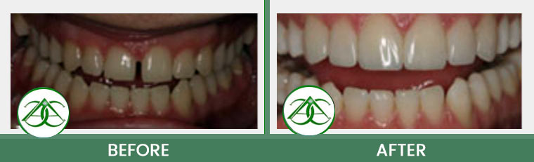 Smile Gallery of Allure Dental Center in Mountain View, CA