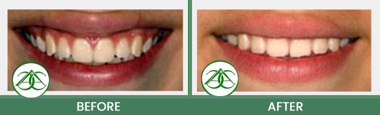 Smile Gallery of Allure Dental Center in Mountain View, CA