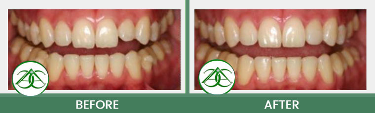 Smile Gallery of Allure Dental Center in Mountain View, CA