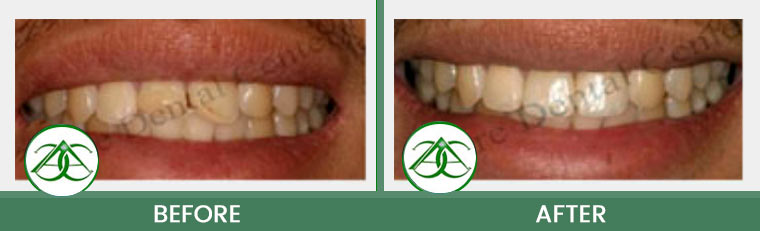 Smile Gallery of Allure Dental Center in Mountain View, CA