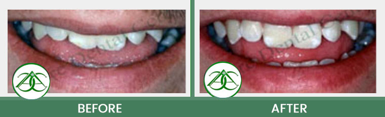 Smile Gallery of Allure Dental Center in Mountain View, CA