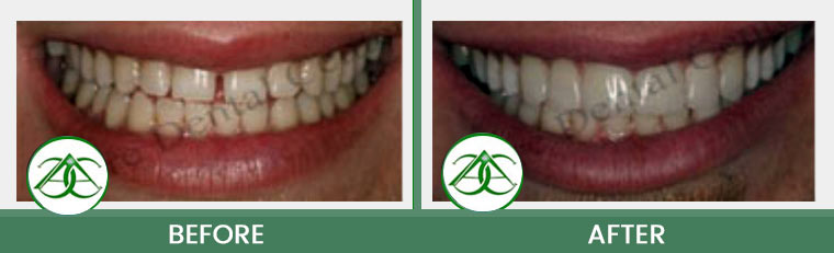 Smile Gallery of Allure Dental Center in Mountain View, CA