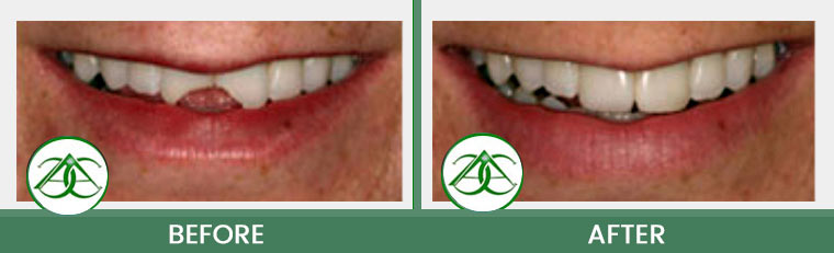 Smile Gallery of Allure Dental Center in Mountain View, CA