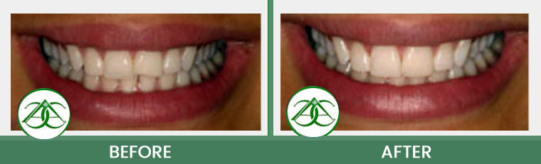 Smile Gallery of Allure Dental Center in Mountain View, CA