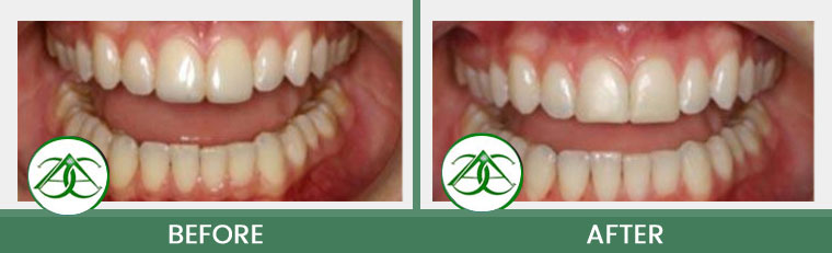 Smile Gallery of Allure Dental Center in Mountain View, CA