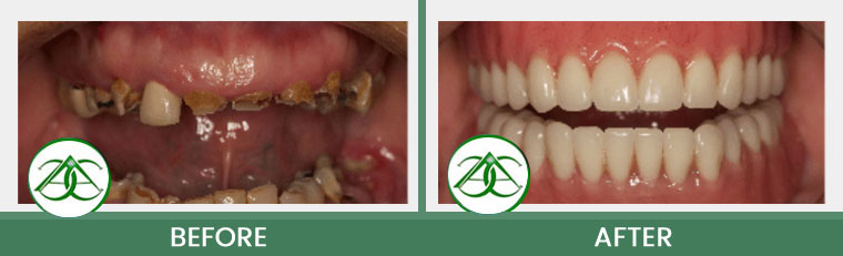 Smile Gallery of Allure Dental Center in Mountain View, CA