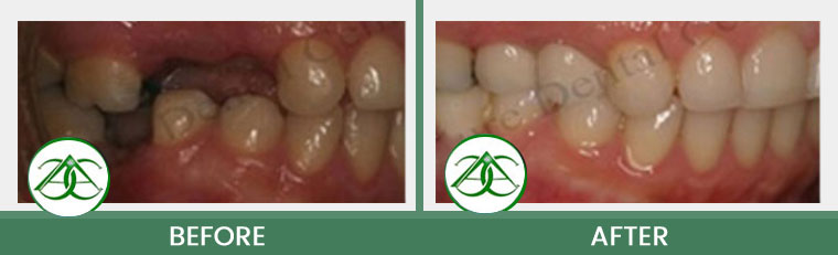 Smile Gallery of Allure Dental Center in Mountain View, CA