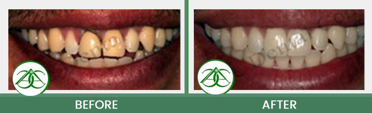 Smile Gallery of Allure Dental Center in Mountain View, CA