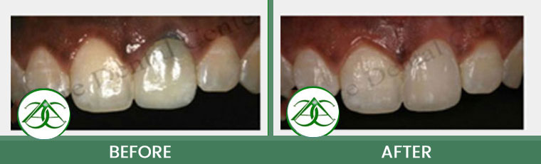 Smile Gallery of Allure Dental Center in Mountain View, CA