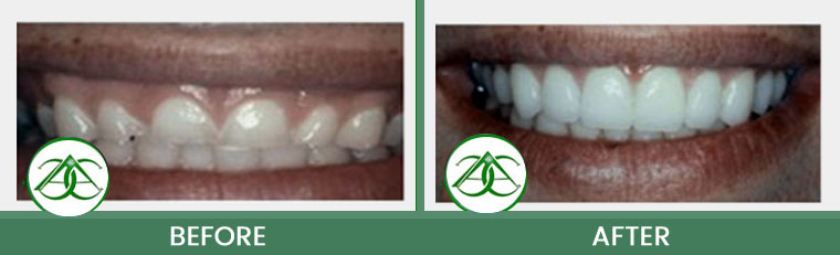 Smile Gallery of Allure Dental Center in Mountain View, CA