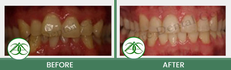 Smile Gallery of Allure Dental Center in Mountain View, CA