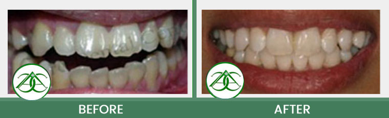 Smile Gallery of Allure Dental Center in Mountain View, CA