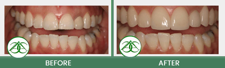 Smile Gallery of Allure Dental Center in Mountain View, CA