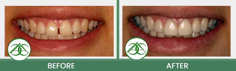 Smile Gallery of Allure Dental Center in Mountain View, CA