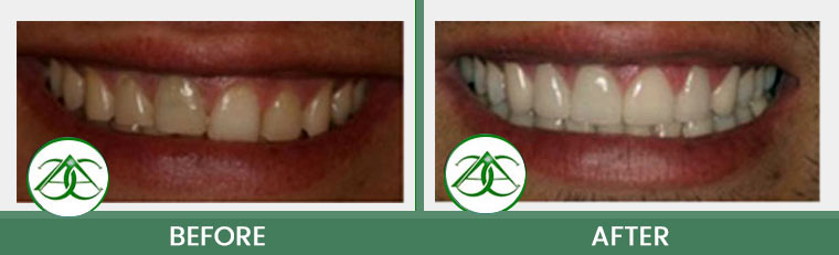 Smile Gallery of Allure Dental Center in Mountain View, CA