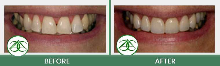 Smile Gallery of Allure Dental Center in Mountain View, CA