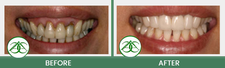 Smile Gallery of Allure Dental Center in Mountain View, CA