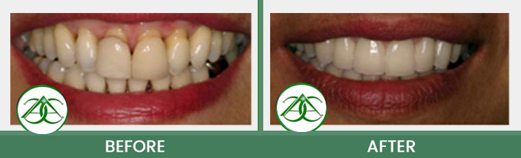 Smile Gallery of Allure Dental Center in Mountain View, CA