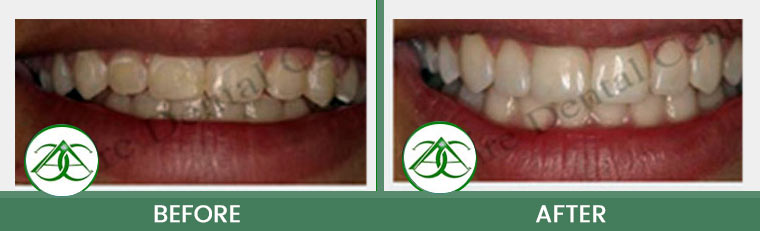 Smile Gallery of Allure Dental Center in Mountain View, CA