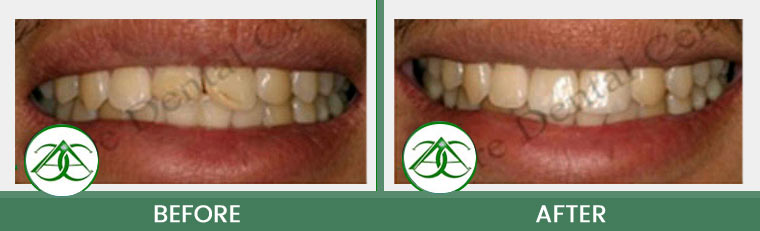 Smile Gallery of Allure Dental Center in Mountain View, CA