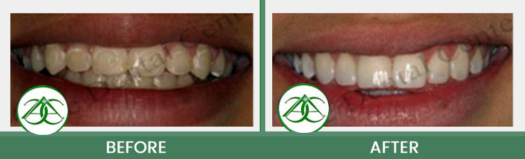 Smile Gallery of Allure Dental Center in Mountain View, CA