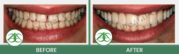 Smile Gallery of Allure Dental Center in Mountain View, CA