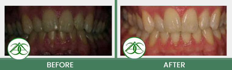 Smile Gallery of Allure Dental Center in Mountain View, CA