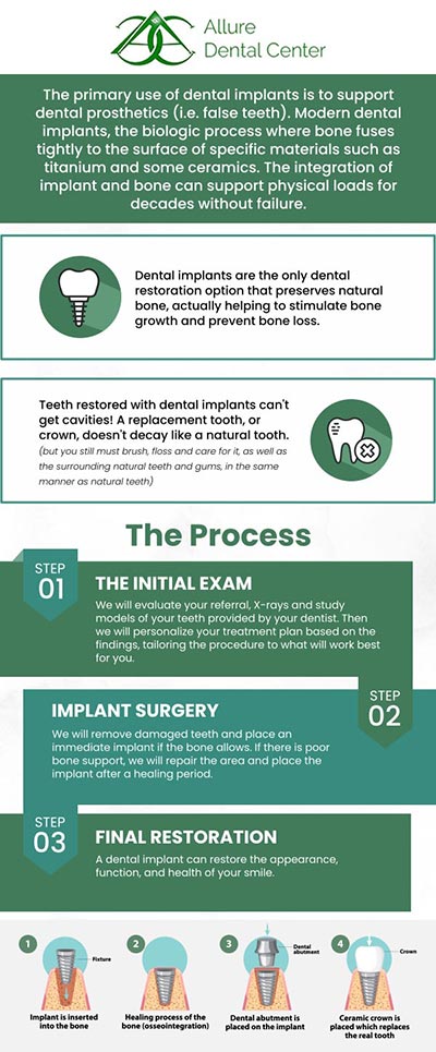 Dental implant specialists, Dr. Trinh Lee and Dr. Suzanna Lee provide effective and quality tooth replacement treatments using restorative dental implants. If you want to replace your missing teeth with dental implants, visit Allure Dental Center to get your beautiful smile back. For more information, contact us or schedule an appointment online. We serve patients from Mountain View CA, and surrounding Bay Area cities. Dental implant specialists, Dr. Trinh Lee and Dr. Suzanna Lee provide effective and quality tooth replacement treatments using restorative dental implants. If you want to replace your missing teeth with dental implants, visit Allure Dental Center to get your beautiful smile back. For more information, contact us or schedule an appointment online. We serve patients from Mountain View CA, and surrounding Bay Area cities.
