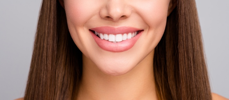 What is the Process for Getting Veneers? - Allure Dental Center in Mountain View, CA